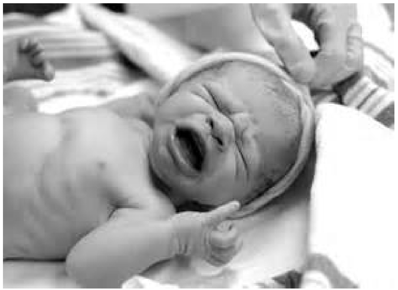 Родившиеся утром. Новорожденные дети наркоманов. Новорожденные с патологиями. Уродства новорожденных детей. Новорожденные дети алкоголиков.